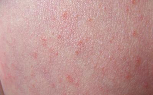 ʪ����ô����� ����ʪ�����ķ���